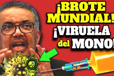 viruela del mono alerta sanitaria en europa y america