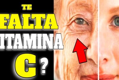 vitamina c detecta la falta y protege tu piel