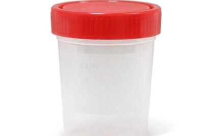 Frasco toma de muestra 100ml de polipropileno grado médico con tapa rosca hermética para muestras líquidas